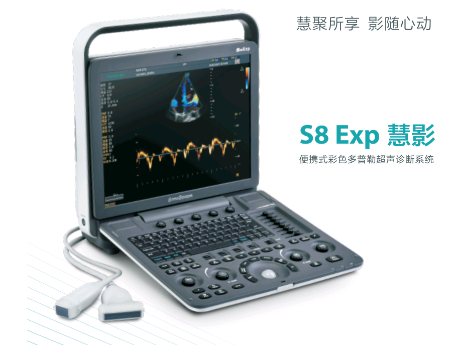 高端便携式彩色多普勒超声图2
